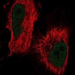 Th-POK Antibody, Novus Biologicals 0.1mL; Unlabeled:Antibodies, Polyclonal